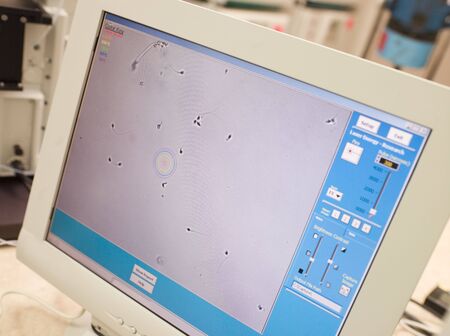 Monitor showing an intra cytoplasmic sperm injection (selective focus)の写真素材