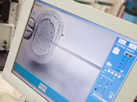Monitor showing intra cytoplasmic sperm injection (selective focus)の写真素材