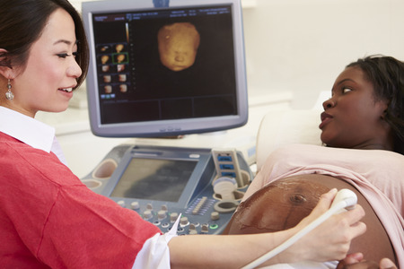 Pregnant Woman Having 4D Ultrasound Scanの写真素材