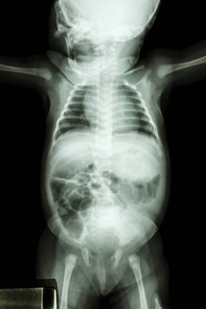 film x-ray whole infant's body : show normal infant's bodyの写真素材