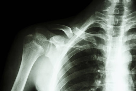 film x-ray right clavicle collarbone    show fracture right clavicleの写真素材