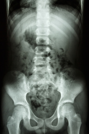 film x-ray show child