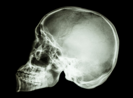 film x-ray skull lateral   show normal asian human s skullの写真素材