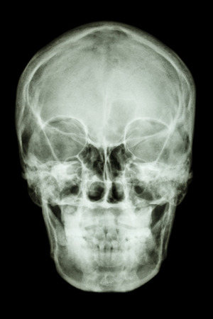 film x-ray skull AP   show normal asian human s skullの写真素材