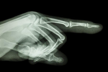 human is pointing the finger  film x-ray の写真素材