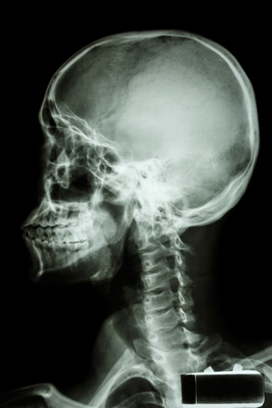 film x-ray human s skull and cervical spineの写真素材