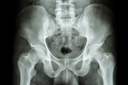 film x-ray human s pelvis and hip jointsの写真素材