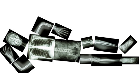 skeleton of human is sleeping and blank area at upper sideの写真素材