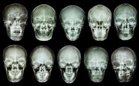 Collection of asian skull  anterior view   Thai people の写真素材