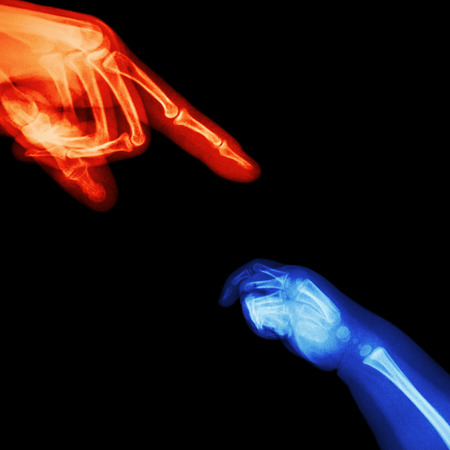 X-ray adult s hand point finger at upper side and baby s hand at lower sideの写真素材