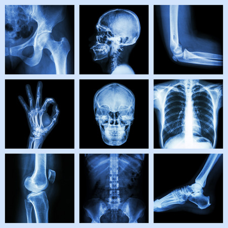 Collection X-ray part of humanの写真素材