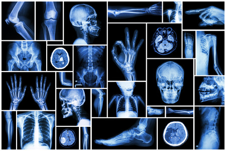 Collection X-ray multiple part of human Collection X-ray multiple part of human