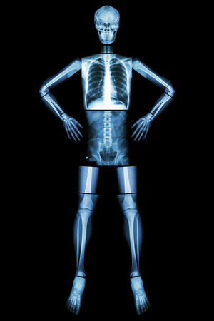 Human bone stand and akimbo (X-ray whole body : head skull neck spine shoulder arm elbow forearm wrist hand finger chest thorax heart lung abdomen back vertebra pelvis hip thigh knee leg ankle foot )の写真素材