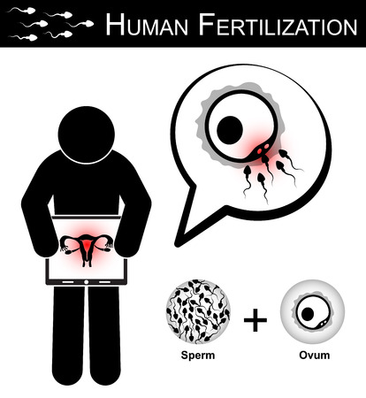 Human Fertilization ( Stick woman hold monitor screen and show imaging of uterus ) , Fertility concept ( sperm cells race to fertilize with ovum ) ( Woman Health Care )のイラスト素材
