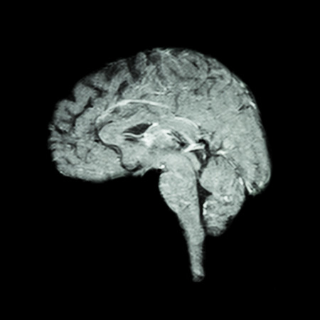 Magnetic Resonance Imaging ( MRI ) of brain  ( Medical , science and healthcare concept )