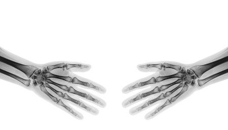 Shake hands .  X-ray normal human hands   ( blank area at upper side )の写真素材