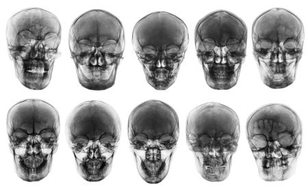 Collection of asian skull . front view  . isolated background .の写真素材