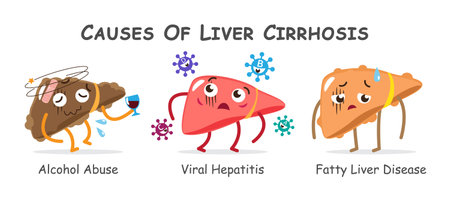 Causes of liver cirrhosis include alcohol abuse, viral hepatitis, fatty liver disease . Collection of cute medical cartoon characters . Vector .のイラスト素材