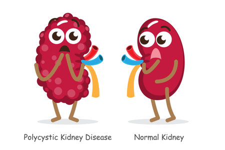 Polycystic Kidney Disease and normal kidney . Cute funny medical cartoon character . Isolated white background . Vector .のイラスト素材