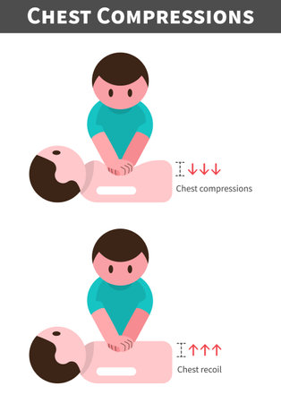 CPR . Cardiopulmonary resuscitation . Procedure of chest compressions . Flat design cartoon characters . Isolate white background . Vector .のイラスト素材