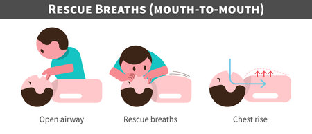 CPR . Cardiopulmonary resuscitation . Procedure of rescue breaths and mouth ot mouth . Flat design cartoon characters . Isolate white background . Vector .のイラスト素材