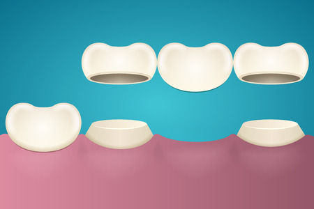 Tooth enamel in section acrossのイラスト素材