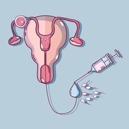 fallopian tubes and artificial insemination processの写真素材
