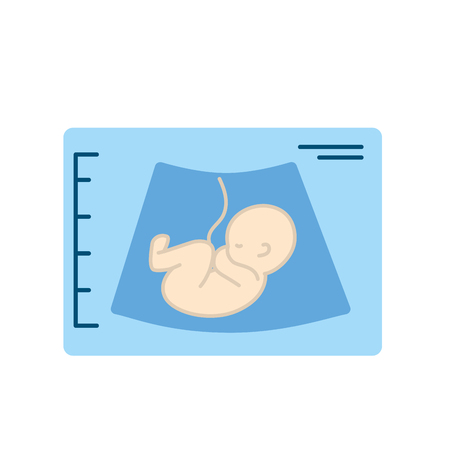 ultrasound of baby with umbilical cordのイラスト素材