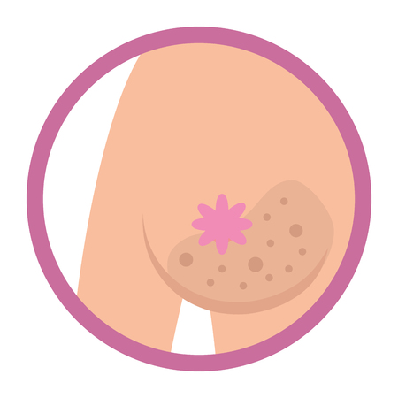 Breast cancer tit color change sign round icon vector illustration graphic designのイラスト素材