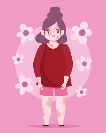 perfectly imperfect, cartoon beautiful woman with problem skin vitiligo, flowers pink background vector illustrationのイラスト素材