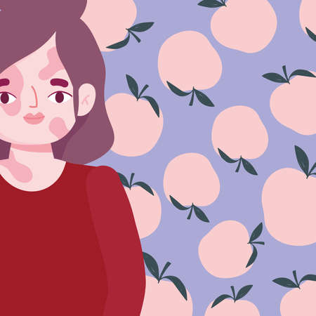 perfectly imperfect, cartoon woman with vitiligo on face character vector illustrationのイラスト素材