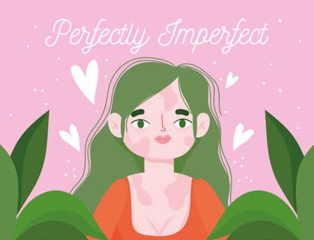 perfectly imperfect, cartoon woman with pigmentation disease vector illustrationのイラスト素材