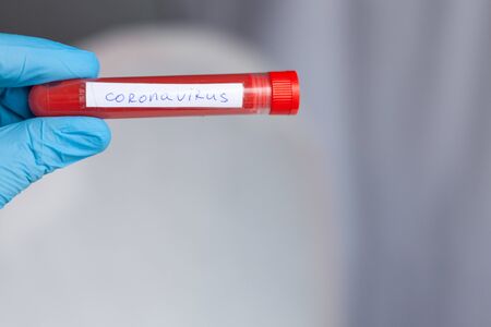 test tube in hand, inscription virus, coronavirus study, virus researchの写真素材