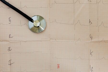 a statoscope on a table with a cardiologist lies on a cardiogram