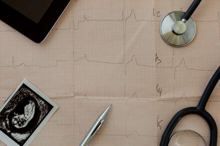 on the table of a gynecologist a medical stethoscope and embryo picture, cardiogram backgroundの写真素材