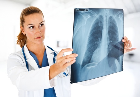 Doctor examining a lung radiographyの写真素材