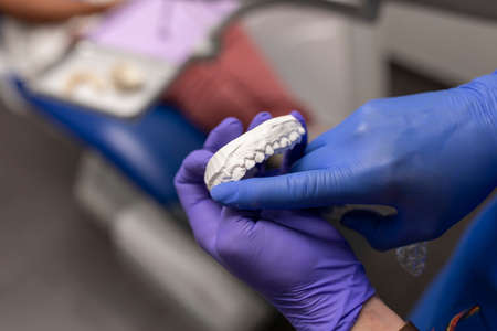 A dentist womans hands holding a plaster denture at the dental clinicの写真素材