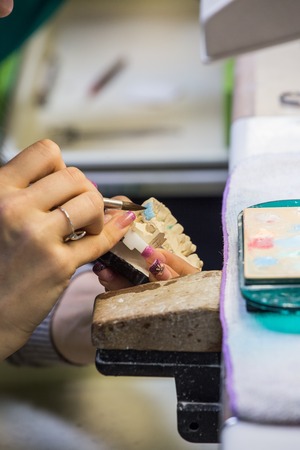 Dental laboratory, manufacturing dental prosthesesの写真素材