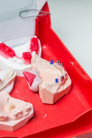 Dental laboratory, manufacturing dental prostheses