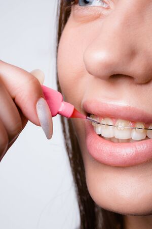 Vertical photo of a girl cleaning braces and teeth with a pink oral brush