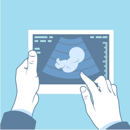Ultrasonography picture, ultrasound scan of fetus in hands, pregnancy symbol, vectorのイラスト素材