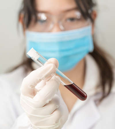 Technician scientist analyzing holding blood sample in test tube in laboratory for testing it on COVID, COVID-19, coronavirus virus analysisの写真素材