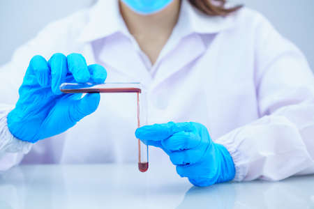 Technician scientist analyzing a blood sample in test tube in laboratory for testing it on COVID, COVID-19, coronavirus virus analysisの写真素材