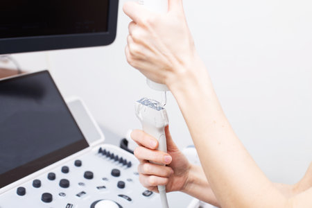 Woman doctors hand applies a medical gel to ultrasonic sensor of ultrasound machine in the clinic.の写真素材