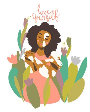 Sweet trendy pieceful image, self acceptance, body positivity. Woman with vitiligo skin condition. Love yourself lettering. Motivation vector art in minimal style.のイラスト素材