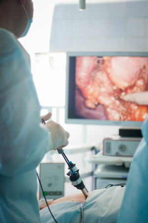 gallbladder removalin the operation theatreの写真素材