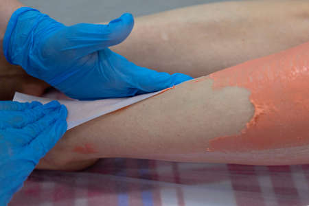 The master removes the wax with the help of special bandage stripsの写真素材