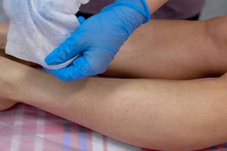Depilation of the lower leg.Removal of unnecessary leg hair in a beauty salon.の写真素材