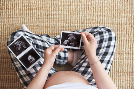 Top view of a pregnant woman holding ultrasound image. Concept of pregnancy, health care, gynecology, medicine. Young mother waiting of the baby. Close-up, copy space, indoors.の写真素材