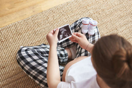 Pregnant woman holding ultrasound image. Concept of pregnancy, health care, gynecology. Young mother waiting for the baby. Close-up, copy space, top view.の写真素材